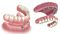 Artistic Denture, Roseburg, Oregon: Dentures, denturists, false teeth, partial dentures